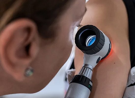 Skin Cancer Treatments