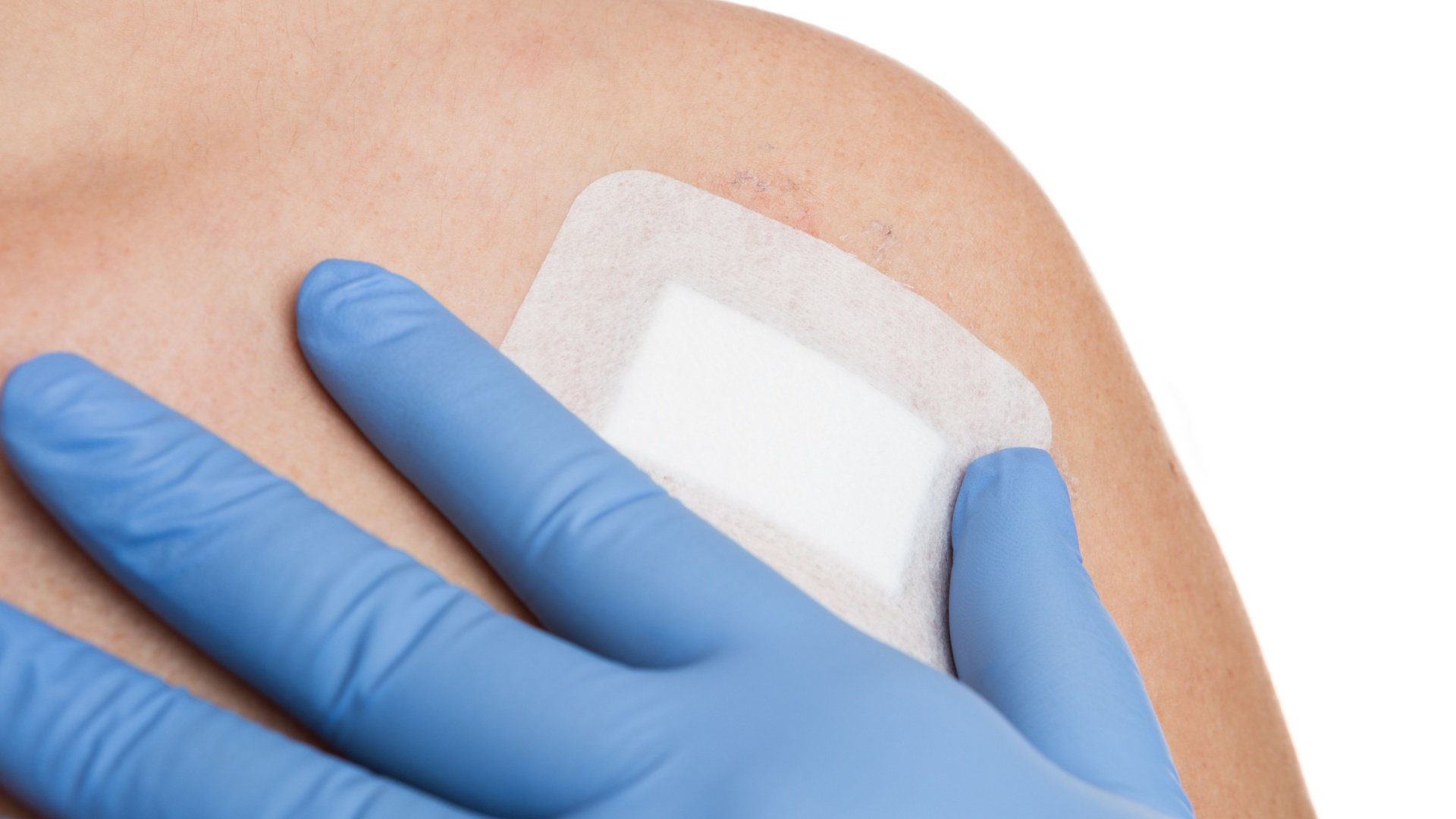 Mohs Surgery Post-Op Instructions